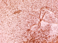 Cortinarius anomalus