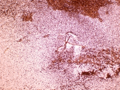 Cortinarius anomalus