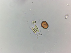 Tetradesmus