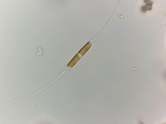 Cylindrotheca closterium