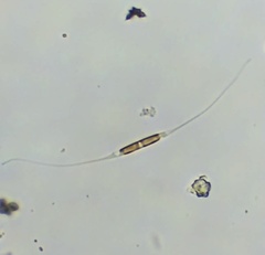 Cylindrotheca closterium