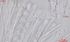 Trichophaea gregaria