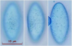 Trichophaea gregaria