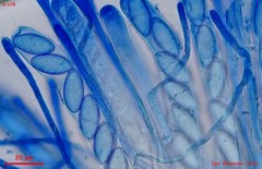 Trichophaea gregaria