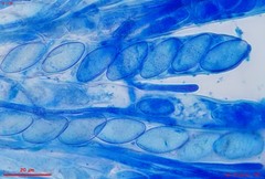 Trichophaea gregaria