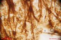 Trichophaea gregaria