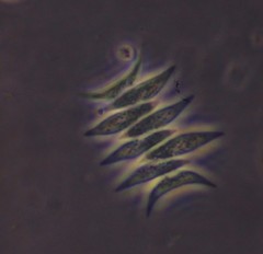Scenedesmus