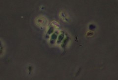 Scenedesmus