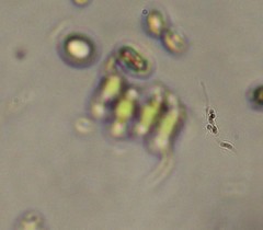 Scenedesmus