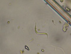 Monoraphidium contortum