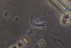 Monoraphidium contortum