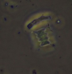 Scenedesmus