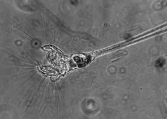 Collotheca