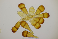 Puccinia magnusiana