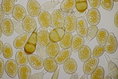 Puccinia magnusiana
