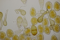 Puccinia magnusiana