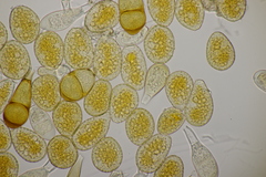 Puccinia magnusiana