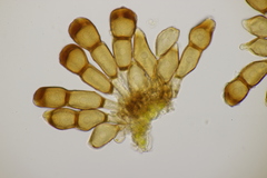 Puccinia urticata