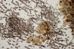 Didymium melanospermum