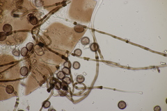 Didymium melanospermum