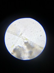 Microspora