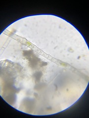 Microspora