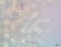 Mycogone rosea
