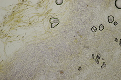 Phlegmacium balteatocumatile
