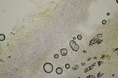 Phlegmacium balteatocumatile