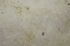 Phlegmacium balteatocumatile