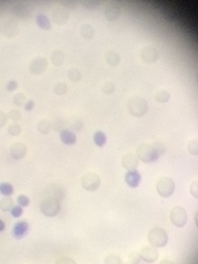 Saccharomyces cerevisiae