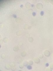 Saccharomyces cerevisiae
