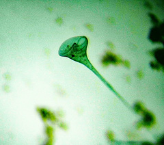Stentor coeruleus