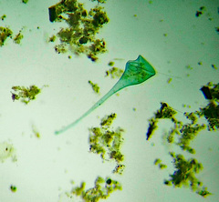 Stentor coeruleus