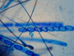 Melastiza cornubiensis