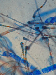 Melastiza cornubiensis