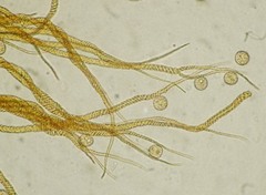 Trichia crateriformis