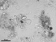 Scyphosphaera apsteinii