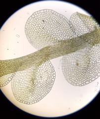 Solenostoma gracillimum