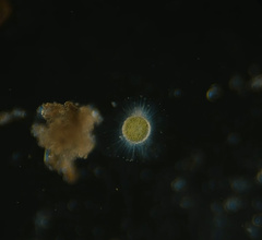 Acanthocystis
