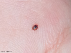 Scymnobius ecuadoricus