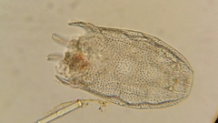 Keratella serrulata