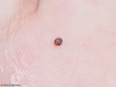 Scymnobius ecuadoricus