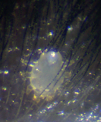 Myobiidae