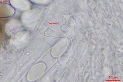 Lasiobolidium