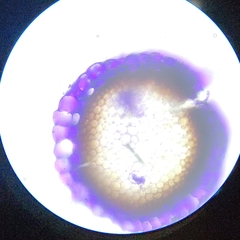 Sphagnum platyphyllum