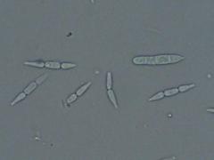 Isthmolongispora