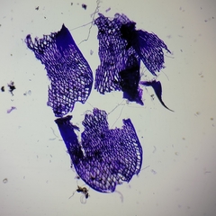 Sphagnum teres