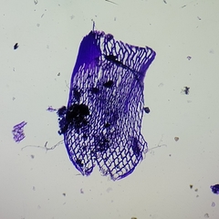 Sphagnum teres