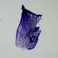 Sphagnum teres